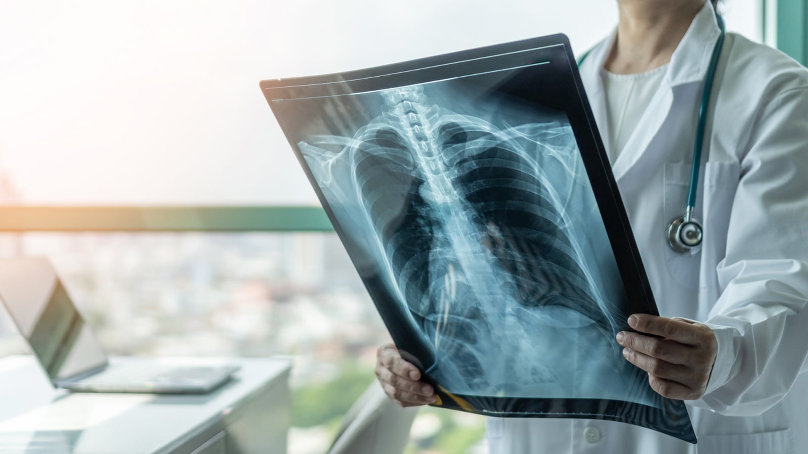 Advanced Digital X-Ray Imaging